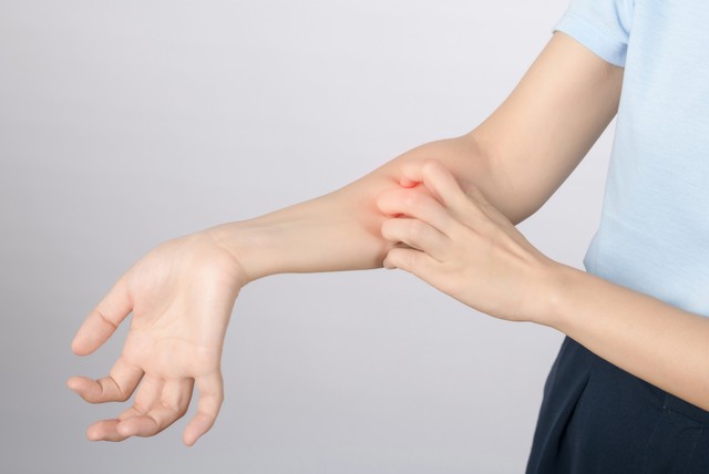 Hisztamin allergia – tünetek, amik elárulják, ha érintett