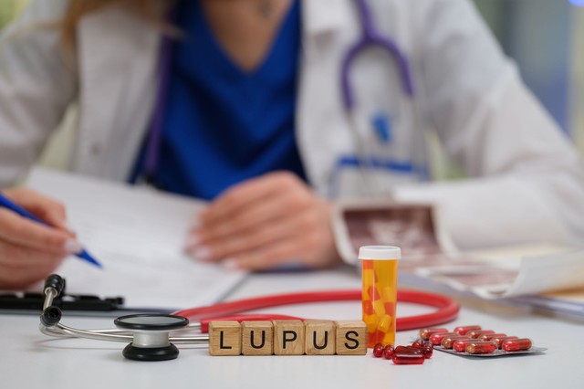 A nagy imitátor: a lupus korai tünetei, amelyeket soha ne hagyjon figyelmen kívül