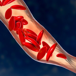 Új hibridműtő Szegeden: Agyi érelzáródáskor hat órán belül életet menthetnek című cikk nyitóképe