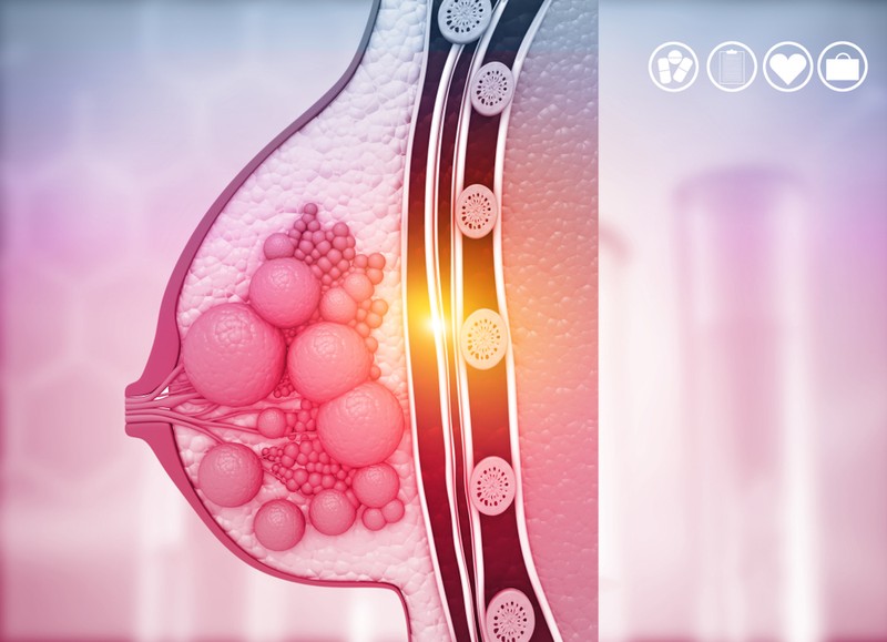 Jóindulatú emlődaganatok tünetei, vizsgálata és kezelési lehetőségei