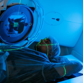 Sugárkezelés: hogyan zajlik, miként hat a testre, és mit tehetünk a mellékhatások enyhítéséért? című cikk nyitóképe