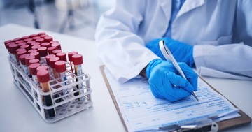  Hogyan mutatható ki a daganat vérből és vizeletből? 