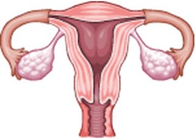 A petefészek daganat tünetenek felsorolása életeket menthet?