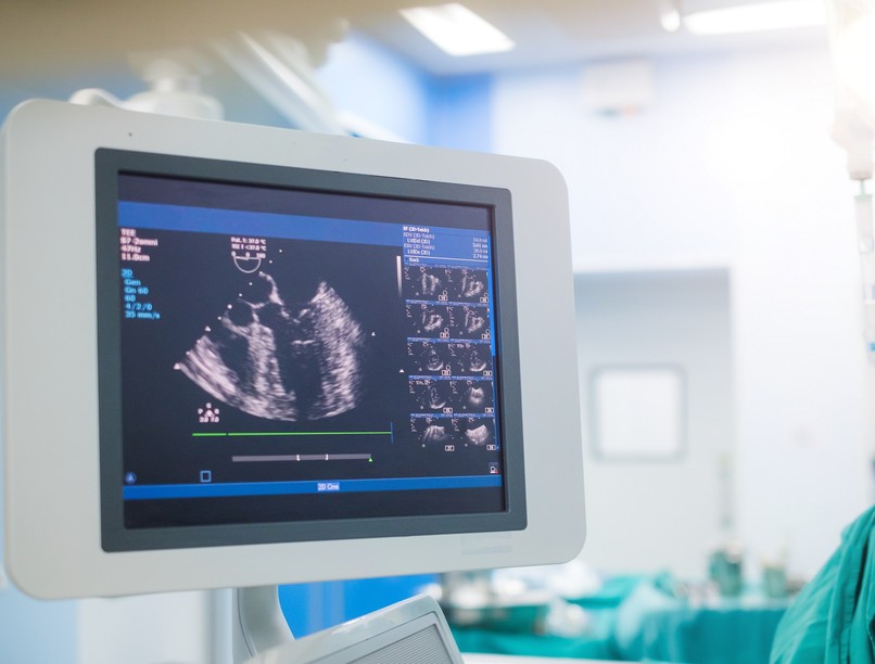 szívultrahang vizsgálat típusai mikor indokolt, hogyan végzik