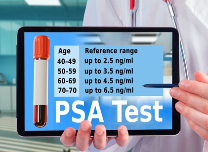 Mi a normális PSA-szint életkor szerint? Ezt jelzik a csillagos eltérések a leleten című cikk nyitóképe