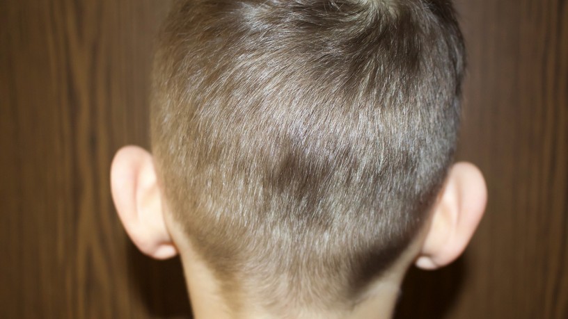 orvos valaszol elálló fül kezelése