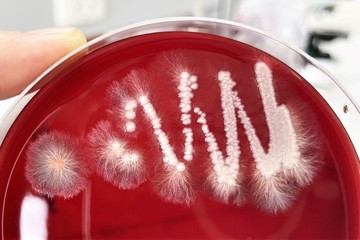 Candida-fertőzésre gyanakszik? Ezzel a módszerrel derítheti ki biztosan!