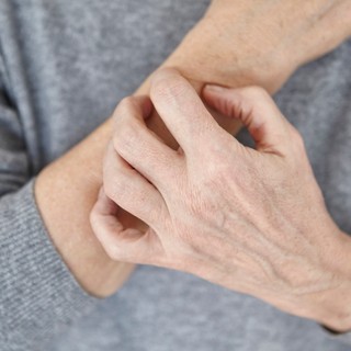 Ilyen nyomokat hagy a bőrön a pajzsmirigyzavar című cikk nyitóképe