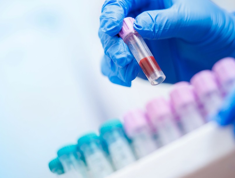 vérvétel teszt szív LDL koleszterin apoB