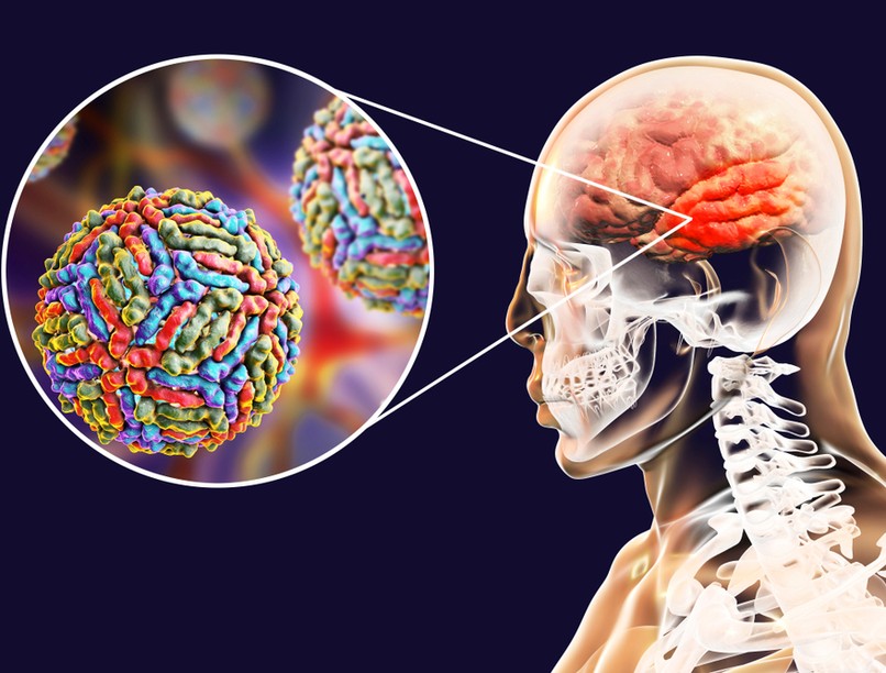 nyugat_nilusi_laz_agyhartya_1