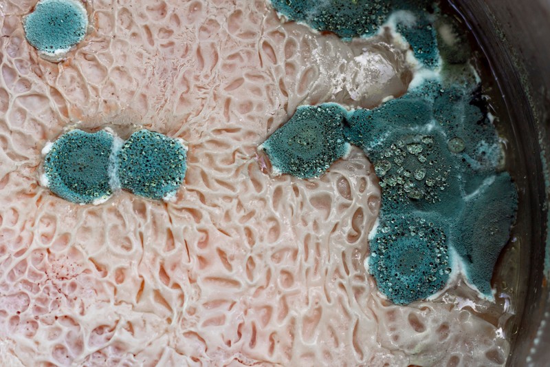 Nemcsak a bőrén és a körmén jelenhet meg gomba, hanem a belső szervein is