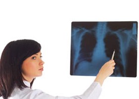 COPD-kalauz: kell-e antibiotikumot adni?
