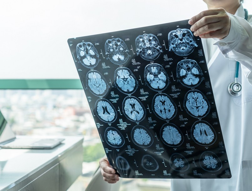 rák gyógyszer alzheimer-kór gyógyítás