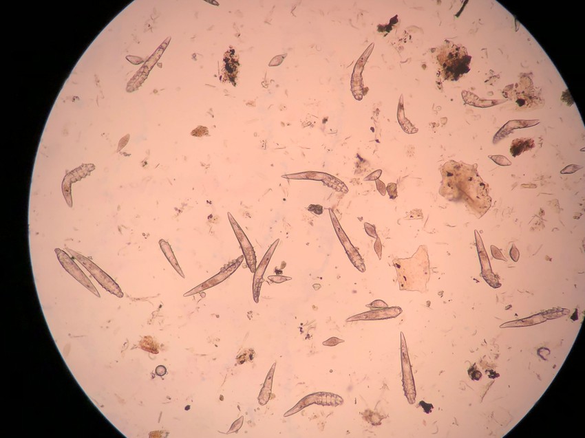 A szőrtüszőgyulladás a szőrtüszőre lokalizálódó gennyes elváltozás. A kiváltó mikroorganizmus a legtöbb esetben a Staphylococcus aureus baktérium.