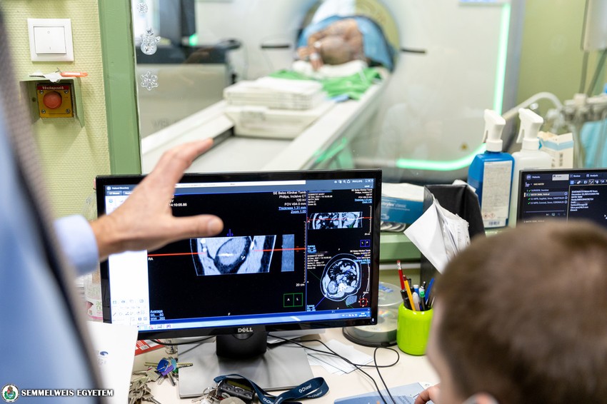 Fagyasztással kezeltek daganatos betegeket a Semmelweis Egyetemen.