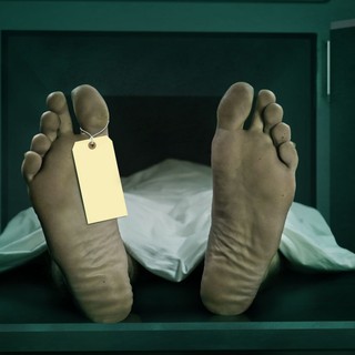 Meglepő felfedezés boncoláskor: ezért lehetnek színesek a nyirokcsomók halál után című cikk nyitóképe