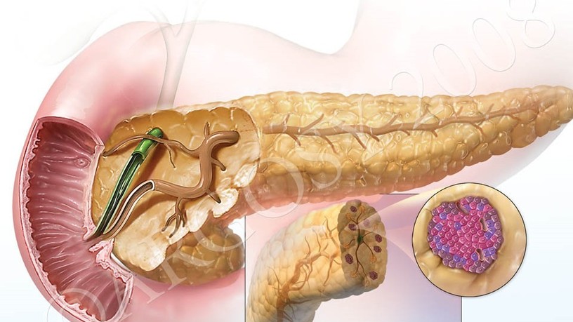 pancreas_0