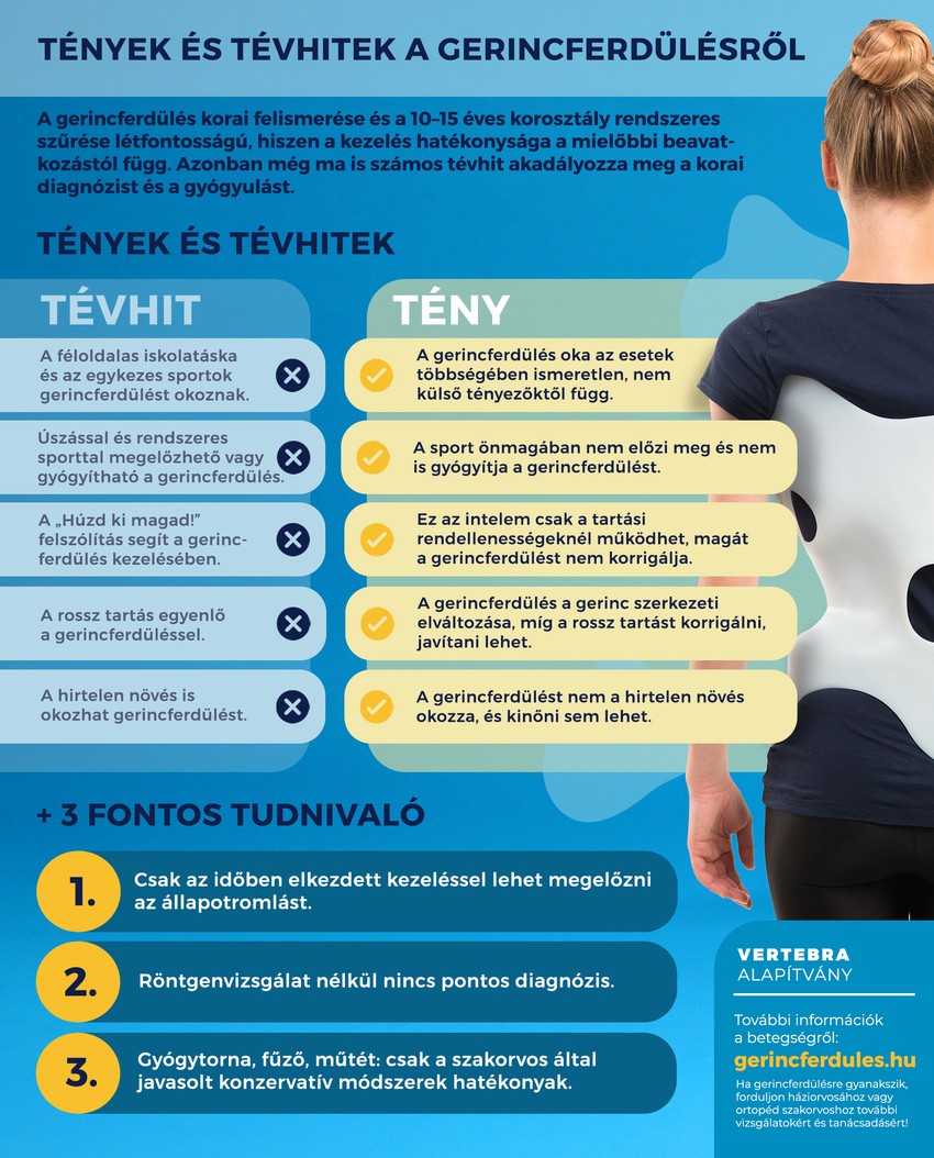 A közkeletű tévhitek eloszlatása miatt ugyancsak fontos, hogy a gerincferdülést megkülönböztessük a tartáshibáktól.
