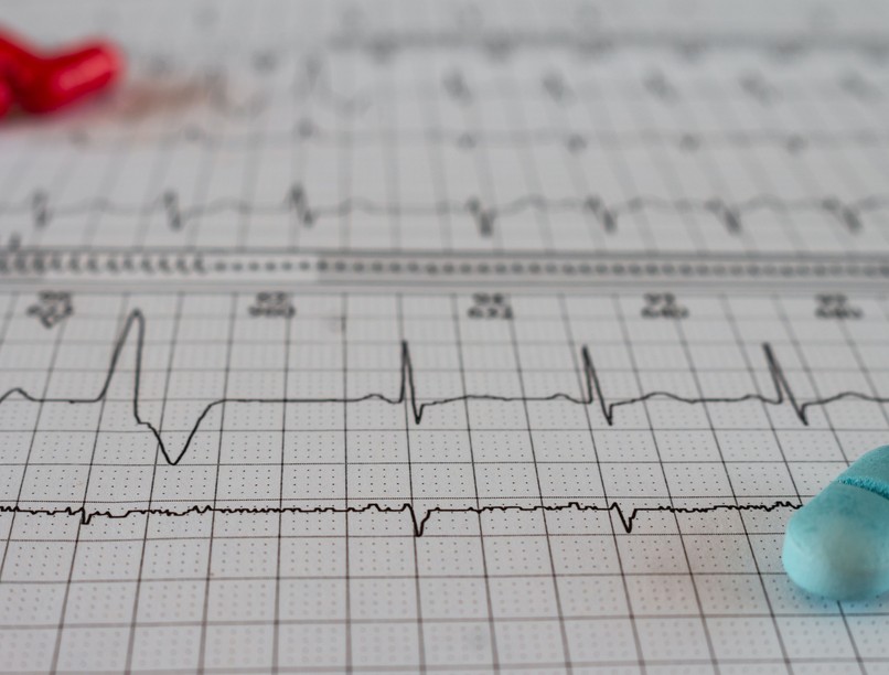 szívbetegség, stressz, tünet jelez menedzserkardiológia