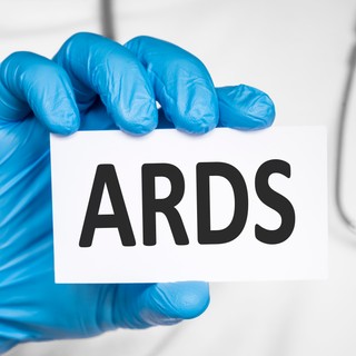 Akut légúti distressz szindróma (ARDS) című cikk nyitóképe