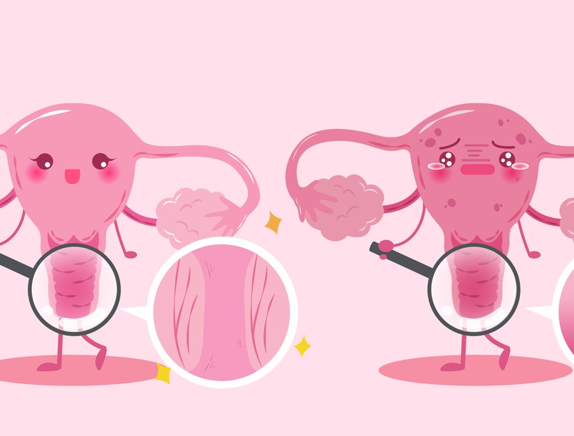 Petefészek elégtelenség tünet vizsgálat kezelés