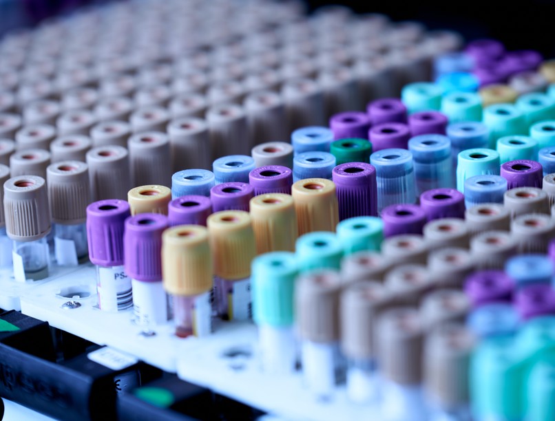 lyme-kór, teszt, vér, kullancs