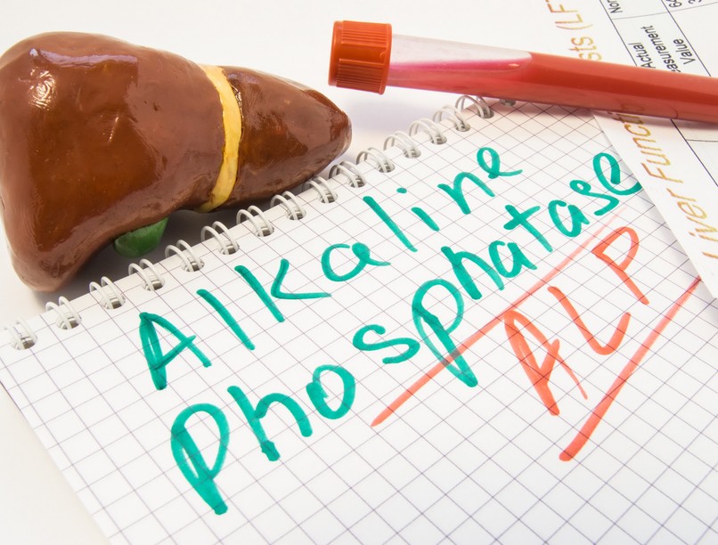 mit jelent ALP érték laborlelet