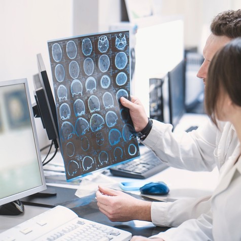 PTE-kutatás: közelebb kerülhetünk az epilepszia és a Parkinson-kór pontosabb felismeréséhez című cikk nyitóképe