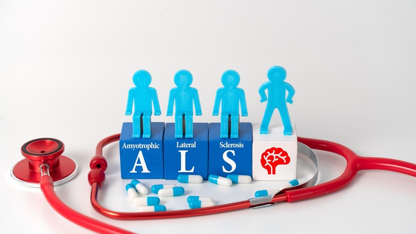 als betegség mitől alakul ki