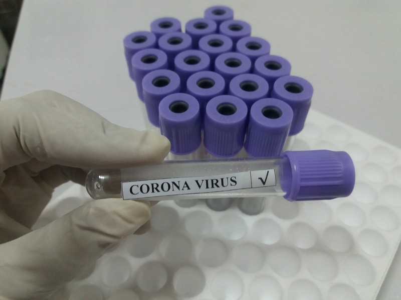 Egyre közelebb a koronavírus ellenszere?