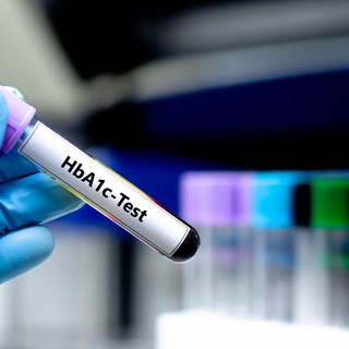 HbA1c, a cukorbetegek időgépe: miért kell ellenőrizni, és miért nehéz néha beállítani? című cikk nyitóképe