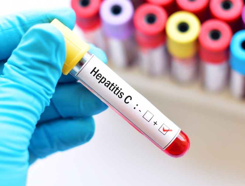 hepatitis c, orvosi nobel-díj, hepatitisz