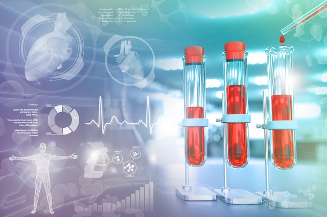 A koleszterinszint-csökkentők megvédhetnek a súlyos Covid-19-től?