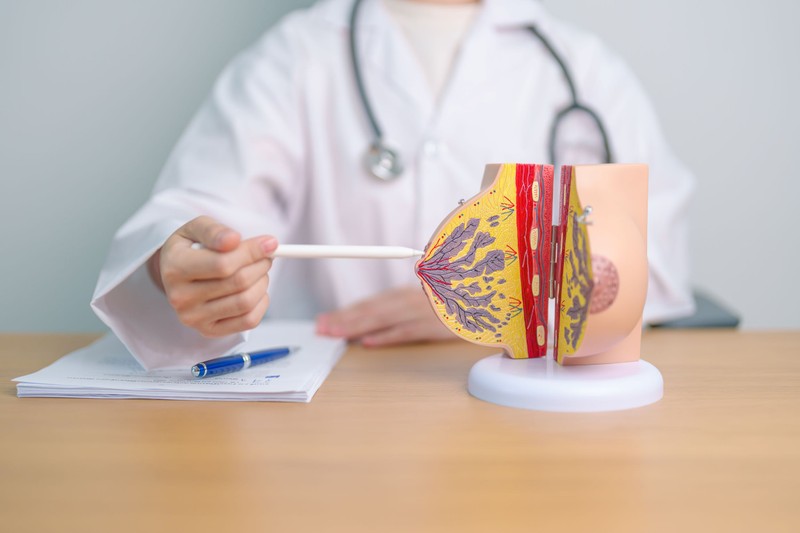 Emlőeltávolítás: nem csak daganat esetén kerülhet rá sor - ilyenkor szükséges a műtét