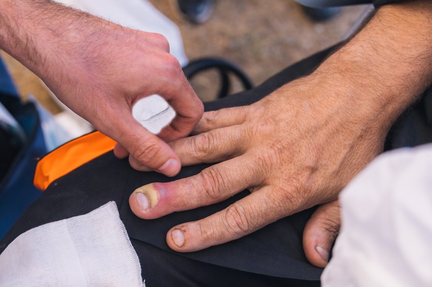 A körömágy-gyulladást könnyen felismerhetjük ránézésre is: megduzzadt, elszíneződött körömágy, duzzanat az ujjban, kivörösödött, fénylő és feszes bőr a köröm körül, később a körömágyon keletkezett duzzanat gennyesedése. 