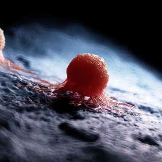 Így készítik elő az áttéteket a daganatsejtek című cikk nyitóképe