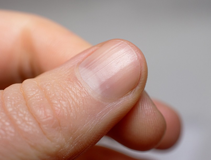 fehér boltív köröm lunula