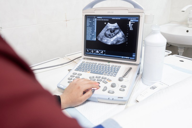 Molaterhesség (Mola hydatidosa) tünetei, vizsgálata és kezelése