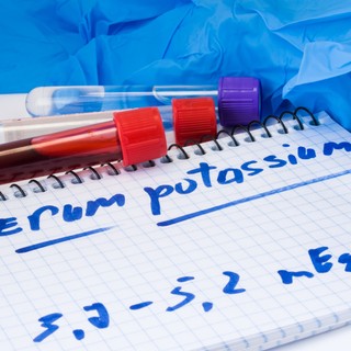 Mit jelent a kálium érték a laborleleten? című cikk nyitóképe