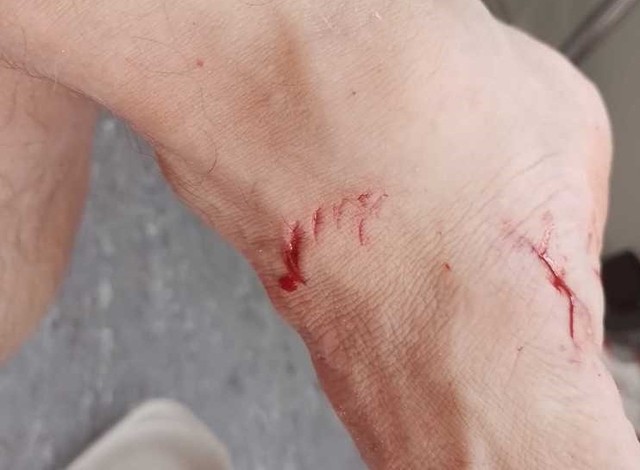 Cápa támadt egy úszóra: először csak egy kis ütést érzett a lábán, aztán ez történt