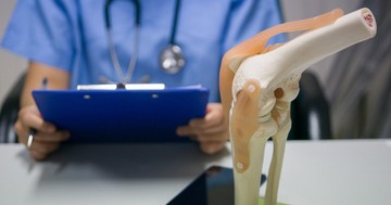  Így előzze meg a térdízületi kopást! 