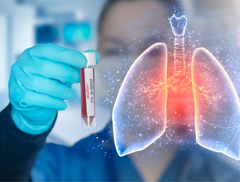 COVID-19, tüdő, koronavírus, vakcinainfó, orvos válaszol