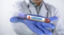 Miért ritka az Rh-negatív vércsoport? című cikk nyitóképe