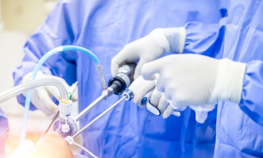 Az endoszkópia a gyomor-bél traktus eszközös vizsgáló módszere. Mikor van szükség endoszkópos vizsgálatra, és mit mutat ki?