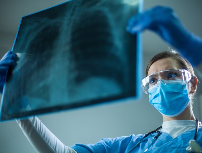 covid, koronavírus, tüdőgyulladás, gyulladás