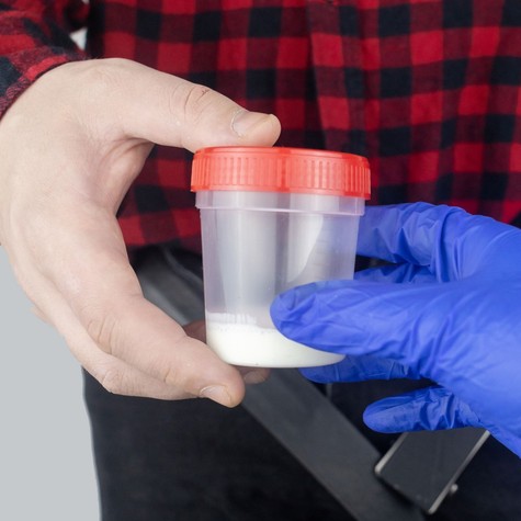 Gyakoribb ejakuláció, jobb spermakép? Ezt mondják erről friss kutatások című cikk nyitóképe