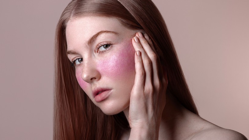 arc piros vörös lupus rosacea autoimmun betegség