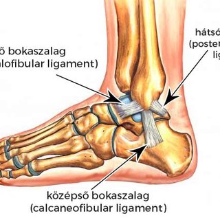 Mi az ínszalagszakadás? című cikk nyitóképe