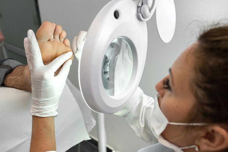 Állandó bőrkeményedéssel küzd? A bőrgyógyász elmondja, mit tehet ellene