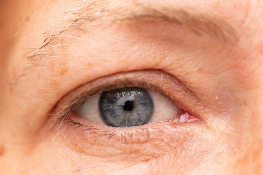 Nem feltétlenül jár fájdalommal.